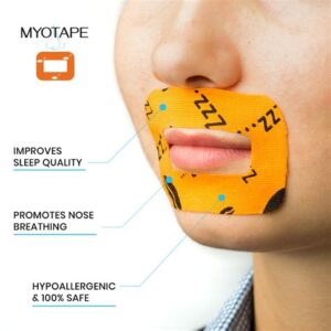 Myotpae